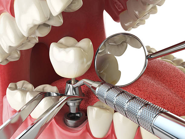 Best Emergency Broken Tooth Repair in West Salem, WI